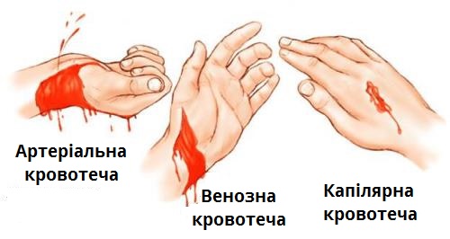 види кровотеч.jpg