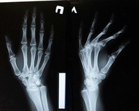 рентген рук.jpg