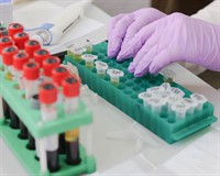 досл крові.jpg