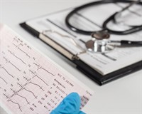 екг розшифрування.jpg