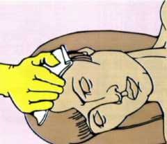 травма голови.jpg