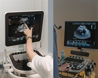 узд апарат.jpg