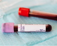 кров проб.jpg