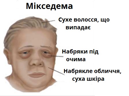міскседема.jpg