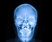 гентген голови.jpg