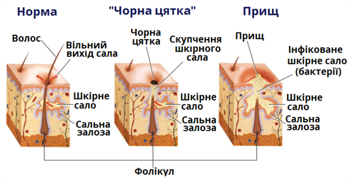 шкіра_пошкодження.png