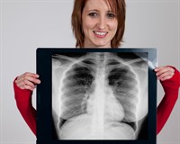 рентген грудей.jpg