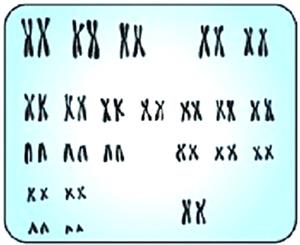 Хромосомний набір жінки.jpg