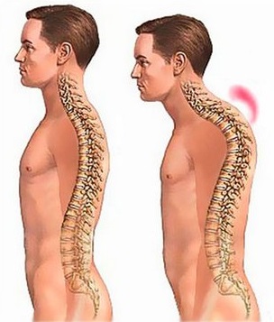 зміна постави.jpg