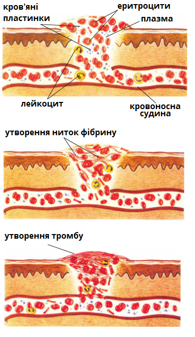 утворення тромбу.png