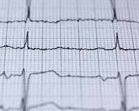 екг лєнта.jpg